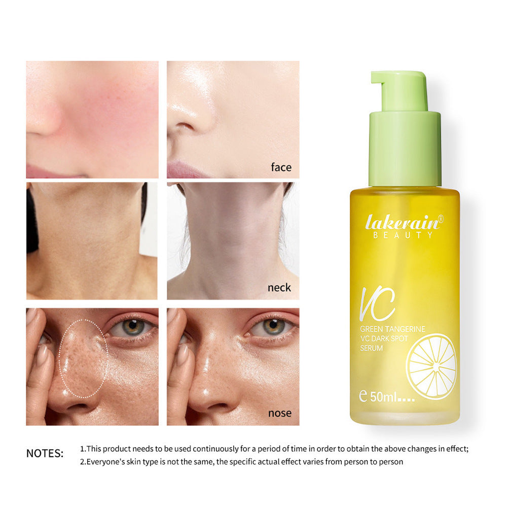 Nourishing And Hydrating VC Skin Moisturizing Lotion