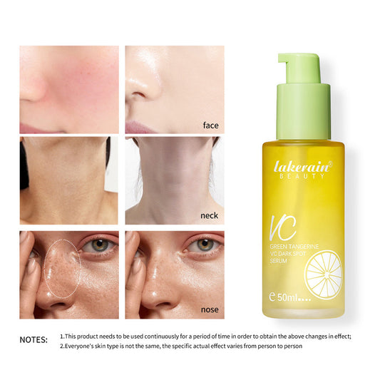 Nourishing And Hydrating VC Skin Moisturizing Lotion